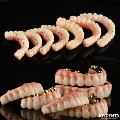 Implant Crown and Bridge The Trusted and Proven Choice for Dental Reconstruction