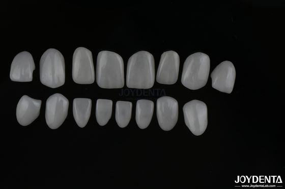 Real Looking Glass Ceramic Teeth Veneers With Glossy Or Matte Surface Finish