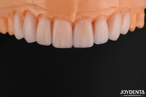 Customizable Glass Ceramic Veneer Natural Looking High Chemical Resistance