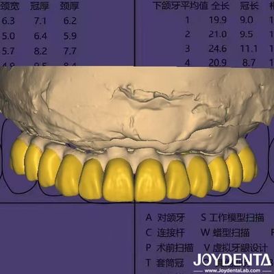 Dental Design Software Digital Wax Up With HIPAA Compliant Data Security