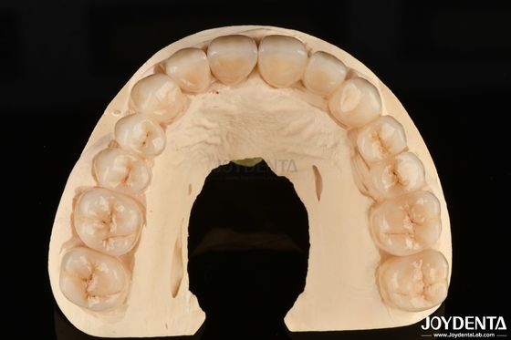 High Resistance To Corrosion Full Zirconia The Preferred Material for White Dental Restorations