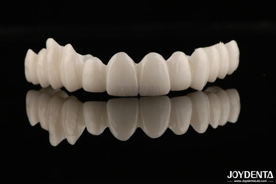 High Aesthetics Full Zirconia High Resistance To Corrosion And Wear For Demanding Applications