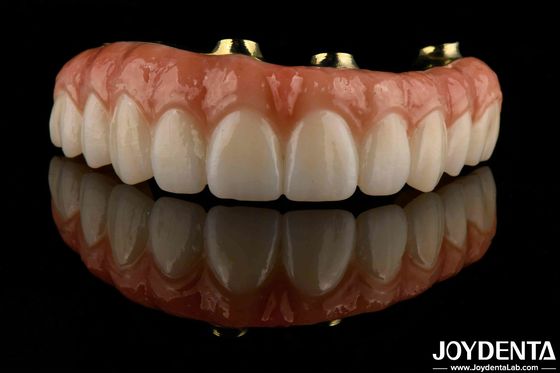 Comfortable Wear Titanium Bar Zirconia Hybrid Bridge High Biocompatibility Long Lasting