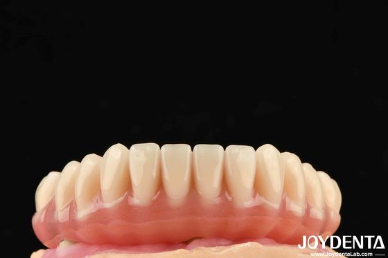 1 Piece Ti-Base Acrylic Teeth Finish Translucent Color Dental Acrylic Resins