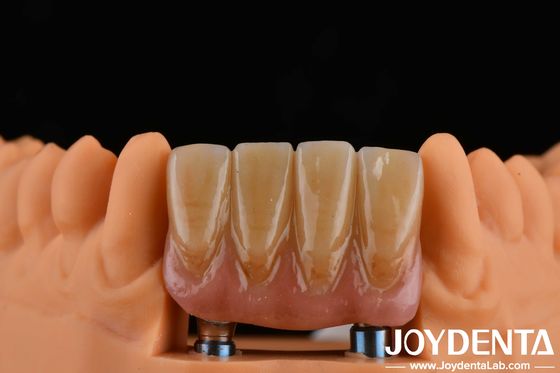 4.5mm Height Finished Abutments Internal Hex Connection Type Compatible With Implant Systems