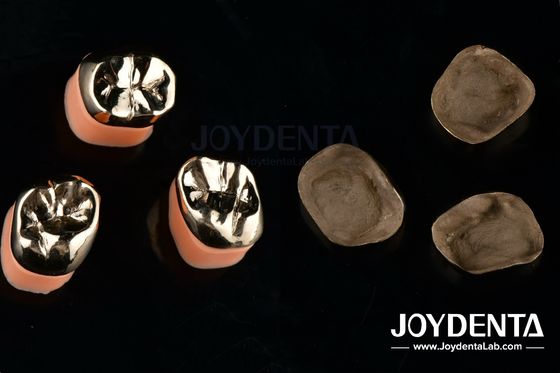Dental Restoration Gold Metal Crowns for Oral Rehabilitation Treatment