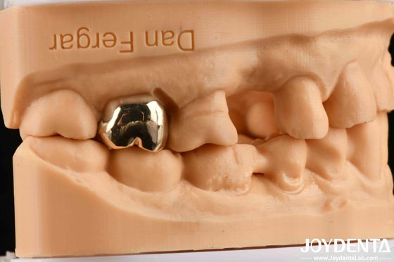 Abrasion Resistant Wax Casting Dental Materials for Enhanced Oral Rehabilitation