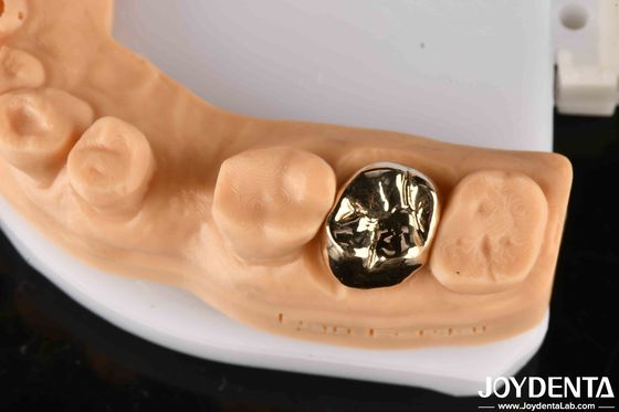 Metallic Material Dental Gold Crown , Gold Tooth Crown For Optimal Oral Rehabilitation