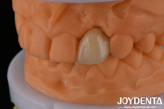 Metallic Material Precise Coloring EMax Maryland With Ideal Color Matching