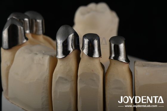 Steel Locator Dental Attachments , Precision Partial Denture Attachments Removable