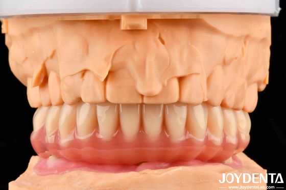 Natural Looking Acrylic Denture Finish High Biocompatibility With Tooth Arrangement Technology