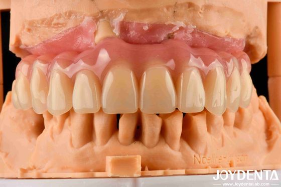 Comfortable Wear Acrylic Denture Finished With Tooth Arrangement Technology