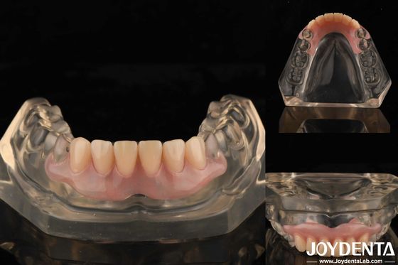 Tooth Arrangement Technology Flexible Denture Finish High Elasticity Customization