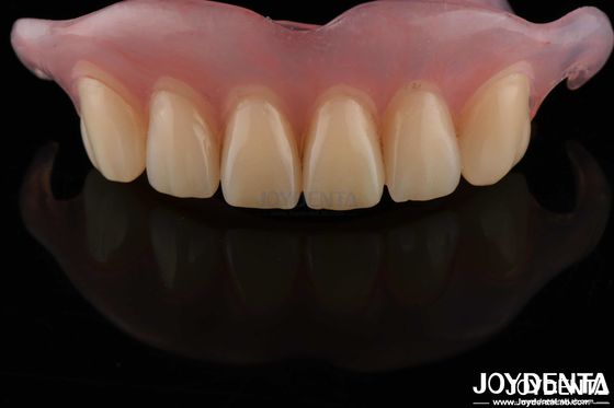 High Stealth Flexible Removable Denture Finished Comfortable Fit Dental Lab