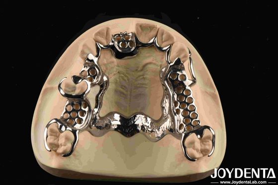 Customized Suppleness Metal Framework Dental Biocompatible Material