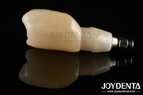 Shoulder Margin Design Dental Implant Bars For Wide Prosthetic Platform Needs
