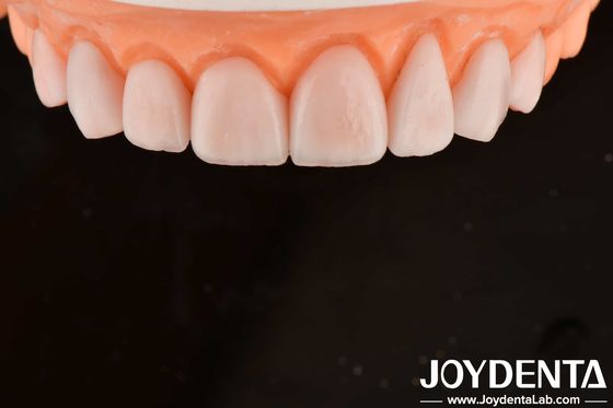 Custom Made IPS Porcelain Emax Veneers Dental Restorations Chipping Resistant