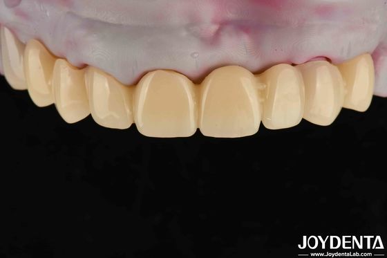 High Transparency PMMA Dental Material Natural Color Lifelike Aesthetics