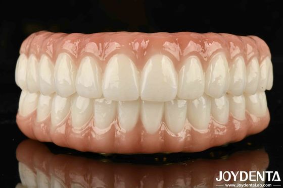 High Biocompatibility Ti-Bar Zirconia Hybrid Bridge For Precise Fit And Missing Teeth Replacement