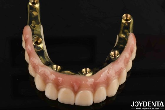 Dental Prosthesis Ti-Bar Zirconia Hybrid Bridge With High Biocompatibility Standards