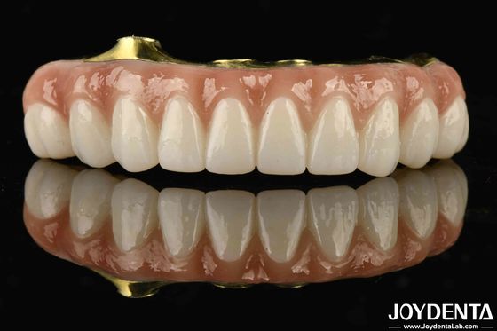 Titanium And Zirconia Comfort Comfortable To Wear Ti-Bar Zirconia Hybrid Bridge For Replacement Of Missing Teeth
