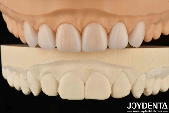 Lightweight Property Flexible Denture Finish Personalized Customization For Diverse Specifications
