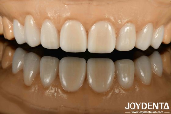 High Stealth Diverse Materials Of Metals And Resins Flexible Denture Finish For Advanced Stealth Technology