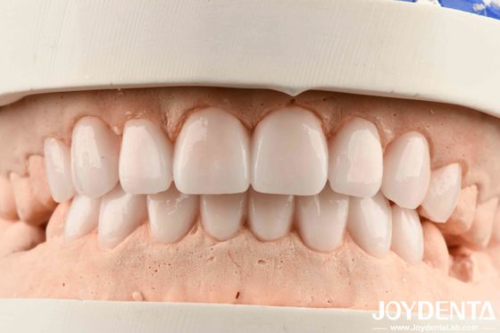 Diverse Materials And Good Elasticity In Flexible Denture Finish For Metals And Resins