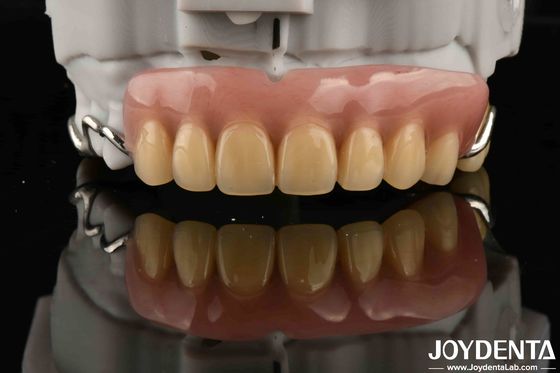 Elaborate Dental Stable Oral Structure  Framework Set Up Teeth Finish For Optimal Oral Health