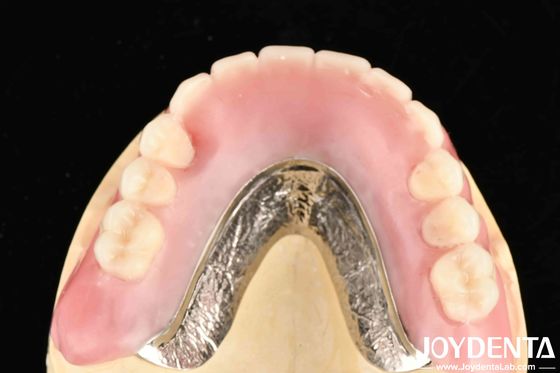 Firmly Connect Row Teeth Elaborate Technology Framework Set Up Teeth Finish For Dental Professionals And Accurate Result