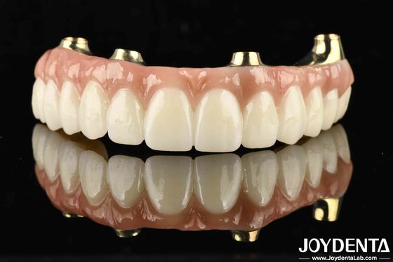 Functionality Ti-Bar Compatible With Natural Teeth And Gums Restores Chewing Function