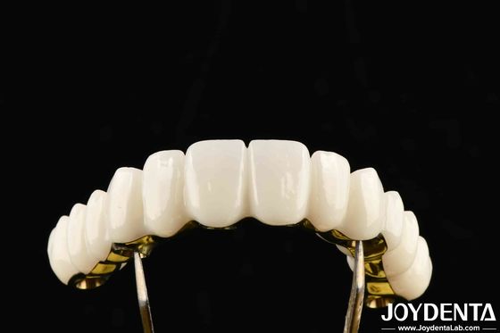 Custom Made Zirconia Excellent Strength For Individualized Dental Solutions
