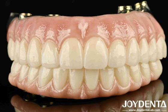 High Durability Ti-Bar Zirconia Hybrid Bridge Custom-made For Personalized Satisfaction Guaranteed