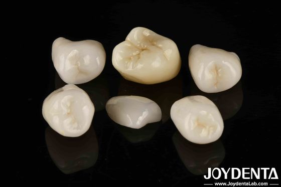 Easy Cementation Emax Inlay Onlay Medium Strength Natural-looking Esthetics