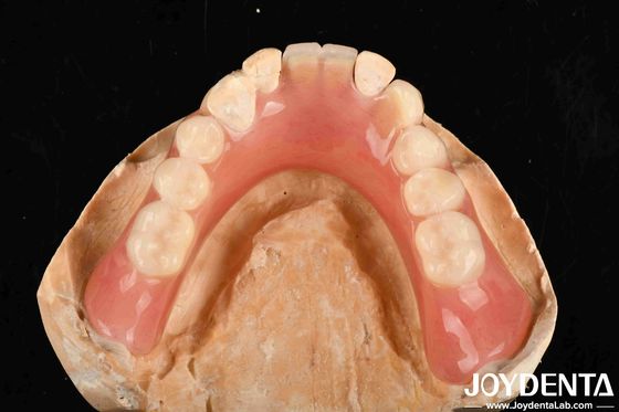 Lightweight Good Biocompatibility Acrylic Denture Finish Personalized Customization In Medical Equipment