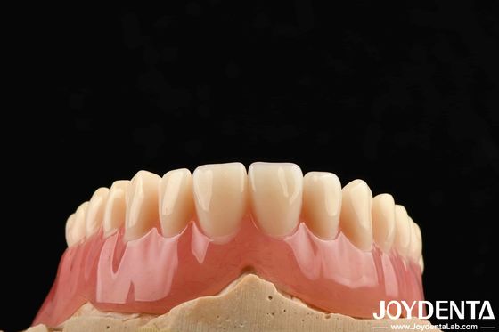 Good Elasticity Acrylic Denture Finish For Lightweight Personalized Customization And Customized Design