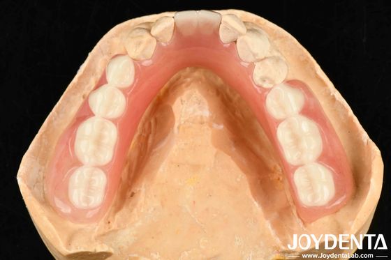 Diverse And Lightweight Resin Material Acrylic Denture Finish