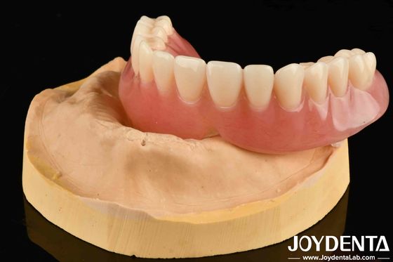 Good Elasticity Acrylic Denture Finish Diverse Tooth Arrangement Technology For Natural-Looking Results