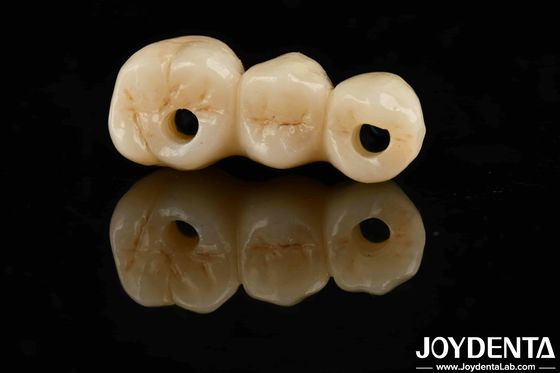 High Aesthetics High Flexural Strength 1000 MPa Full Zirconia For Standards