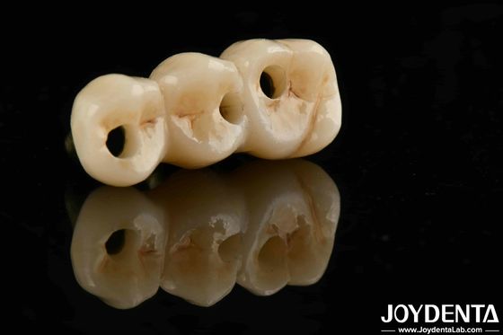 Excellent Biocompatibility And High Strength Color Realistic Full Zirconia For B2B Procurement Solutions