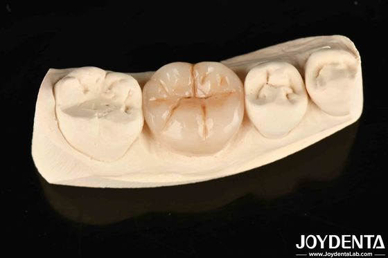 Full Zirconia High Wear Resistance And Strength In Industrial Applications