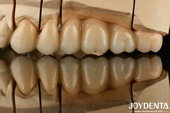 White Full Zirconia With High Resistance To Thermal Shock High Strength