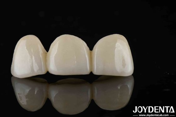 Natural-looking Style With Layers Full Zirconia High Translucency And Aesthetics