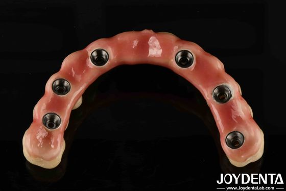 Adjustable Titanium Malong Hybrid Bridge Perfect Combination Of Traditional And Modern Techniques