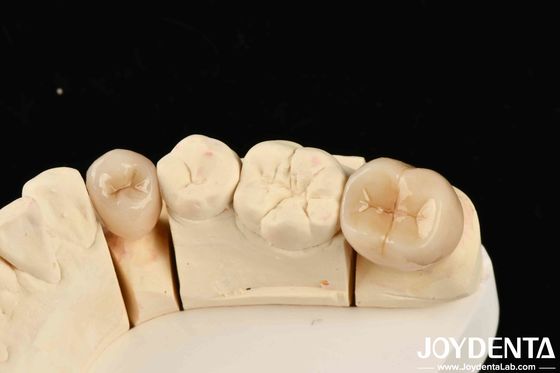 Excellent Biocompatibility Full Zirconia With High Resistance To Corrosion And Flexural Strength Of 1000 MPa