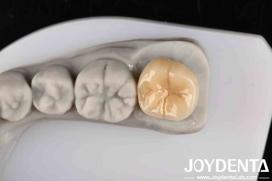 High Resistance To Thermal Shock And Corrosion Full Zirconia With Excellent Chemical Stability