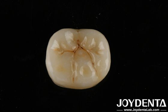 High Translucency Full Zirconia With Layers Biocompatibility And Flexural Strength Of 800 MPa
