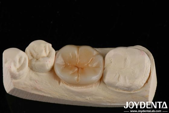 800 MPa Flexural Strength And 8 MPa·m1/2 Fracture Toughness In Multilayer Full Zirconia For Strength Applications