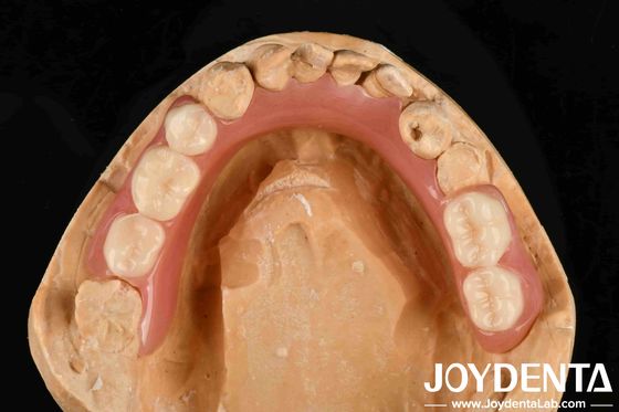 Personalized Customization Acrylic Denture Finish Good Elasticity And Lightweight Property For Enhanced Prosthetic Performance