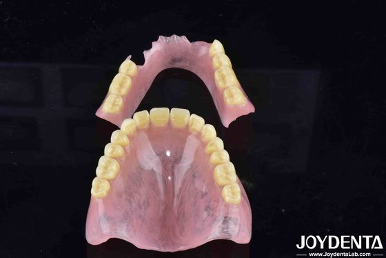 Advanced Tooth Arrangement Technology Acrylic Denture Finish With Good Elasticity And Diverse Features